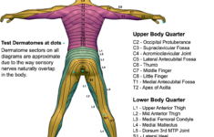 Posterior Dermatome Map QxMD